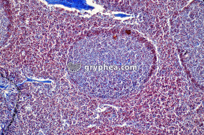 Ganglion lymphatique x40 - gryphea.com